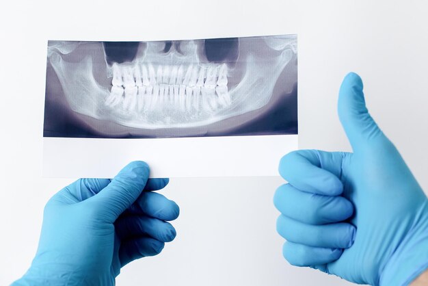 Centrum medyczne Dentysta trzyma w dłoniach zdjęcie zębów Zdrowy styl życia