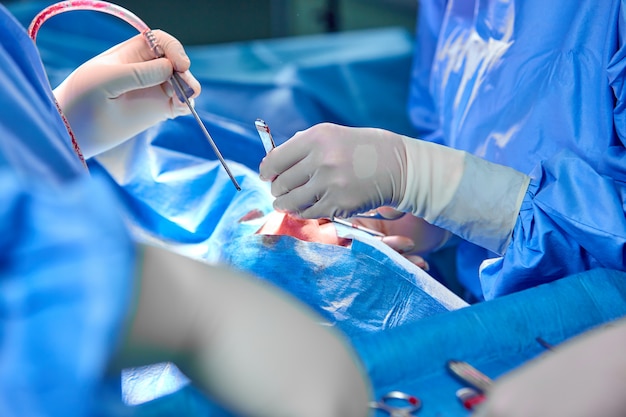 Chirurg I Jego Asystent Wykonujący Operację Plastyczną Nosa W Szpitalnej Sali Operacyjnej.