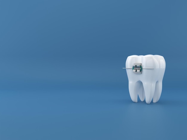 Chirurgia implantów dentystycznych renderowanie 3d