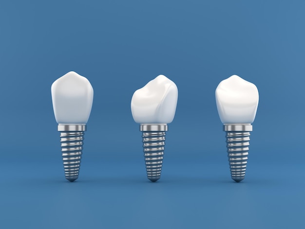 Chirurgia implantów dentystycznych renderowanie 3d