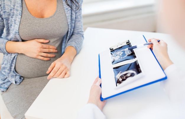 ciąża, ginekologia, medycyna, opieka zdrowotna i koncepcja ludzi - zbliżenie lekarza ginekologa pokazującego obraz USG w schowku kobiecie w ciąży w szpitalu