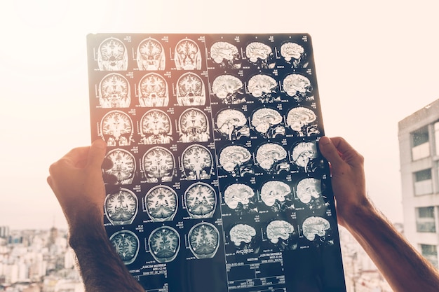 Zdjęcie close-up z męskiej dłoni lekarza patrząc na obraz rezonansu magnetycznego mózgu