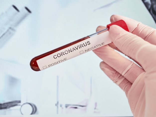 Zdjęcie coronavirus 2019-ncov badanie krwi. wirus koronowy. wirus pandemiczny chiny