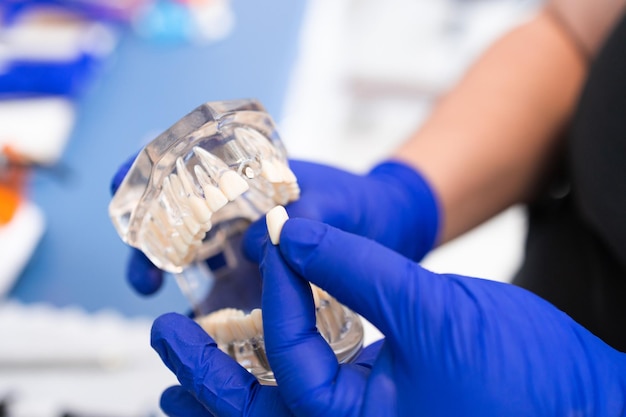 Dentysta trzymający sztuczną dolną szczękę Proteza dentystyczna płytka zębowa Praca protetyczna