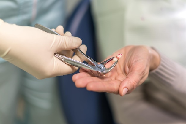 Dentysta Usuwa Ząb Pacjenta W Gabinecie Stomatologicznym