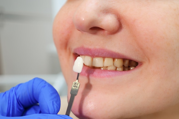 Dentysta z próbkami koloru zębów wybiera odcień dla zębów pacjentki w klinice dentystycznej, zbliżenie