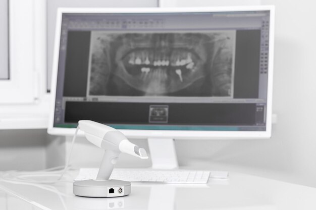 Dentystyczny skaner 3d i monitor w gabinecie stomatologicznym