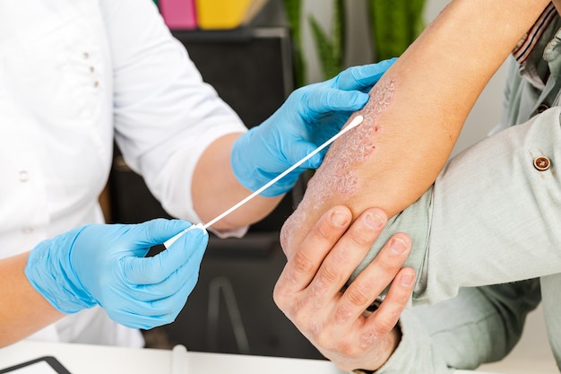 Dermatolog wykonuje analizę skóry chorego pacjenta