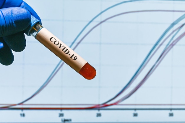 Diagnostyka Pcr Covid19