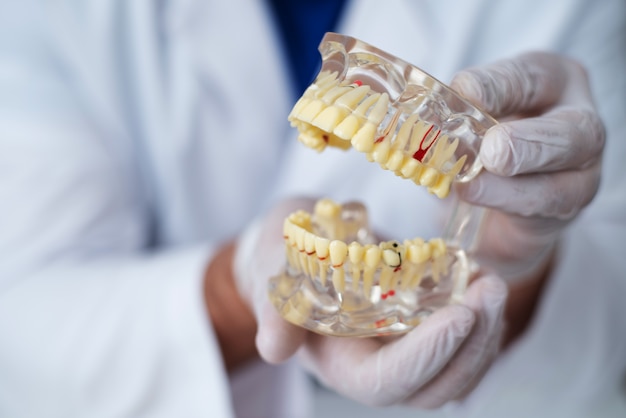 Doktor ortodonta pokazuje instrument na próchnicy zębów