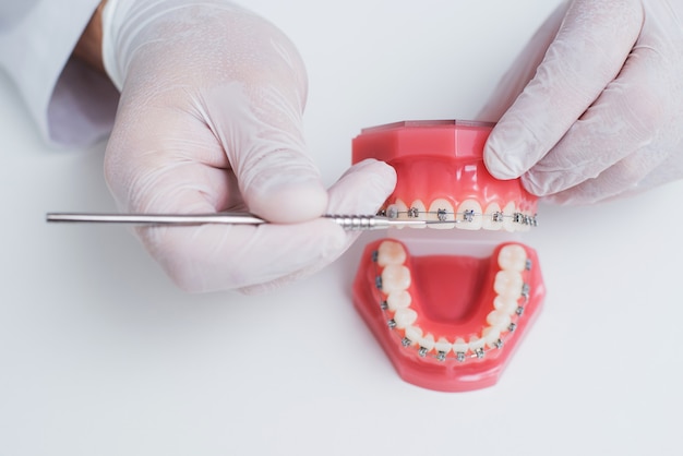 Doktor ortodonta pokazuje, jak układa się system aparatów ortodontycznych na zębach
