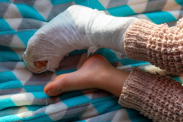 Dziecko z bandażem na nodze złamanie pięty Złamana szyna prawej stopy malucha Mały boi śpiący na niebieskim kocu