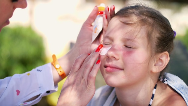 Zdjęcie dziewczęta ciężkie oparzenia słoneczne na twarzy mama smaruje miejsca oparzeń obficie specjalnym kremem