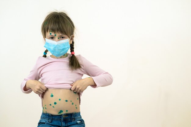 Dziewczynka ubrana w niebieską ochronną maskę medyczną chora na wirus ospy wietrznej, odry lub różyczki z wysypką na ciele