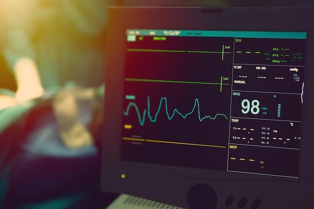 Ekran monitora tętna EKG pulsu w sali operacyjnej w szpitalu