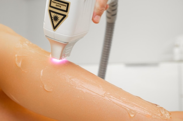Ekspert wykonuje laserową depilację nogi kobiety za pomocą wymazanego wosku, depilację ciała za pomocą prądu elektrycznego.