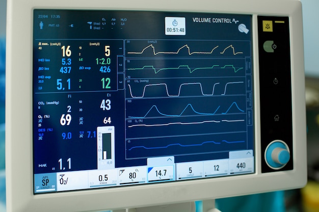 Zdjęcie elektrokardiogram w chirurgii szpitalnej operacyjnej izbie przyjęć pokazuje tętno pacjenta