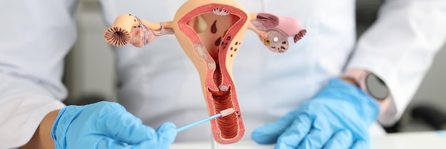 Ginekolog trzyma cytoszczoteczki moczowo-płciowe i model kobiecego układu rozrodczego kobiety
