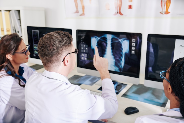 Zdjęcie grupa lekarzy omawiająca prześwietlenie klatki piersiowej na ekranie komputera podczas próby postawienia właściwej diagnozy