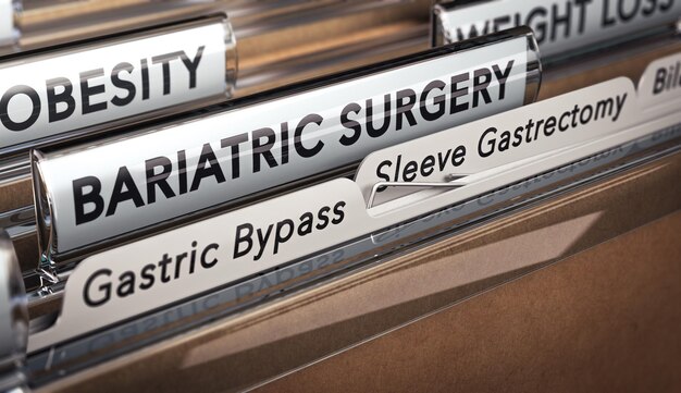 Zdjęcie ilustracja 3d folderu z naciskiem na zakładki z tekstami o chirurgii bariatrycznej, pomostowaniu żołądka i gastrektomii rękawa. rodzaje operacji chirurgicznych stosowanych w przypadku otyłości.