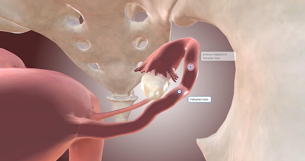 Implantacja zarodka w jajowodzie