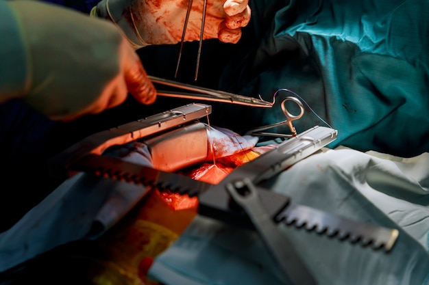 Instrumenty chirurgiczne do operacji na otwartym sercu