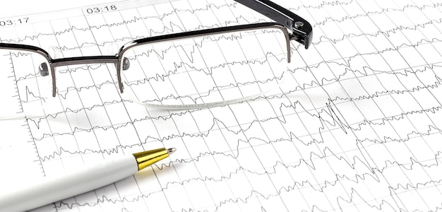 Kardiogram medyczny i okulary, długopis. Koncepcja medyczna Zbliżenie