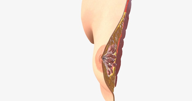 Kobieca pierś składa się z wyspecjalizowanych przewodów tkanki gruczołowej i tłuszczu z leżącą pod spodem warstwą mięśni