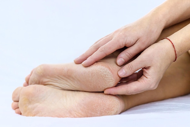 Kobiece stopy wysuszają skórę na piętach Selektywna ostrość