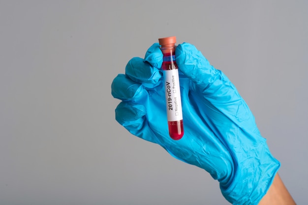 Kobieta Doktor trzymając probówkę z próbką krwi do koronawirusa lub analizy 2019-nCoV.