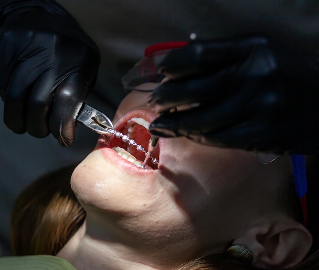 Kobieta na wizytę u dentysty w celu zastąpienia łuków aparatami ortodontycznymi