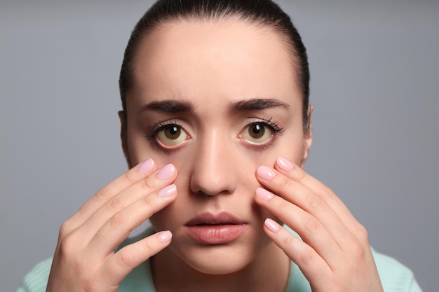 Kobieta sprawdza swój stan zdrowia na szarym tle Żółte oczy jako objaw problemów z wątrobą