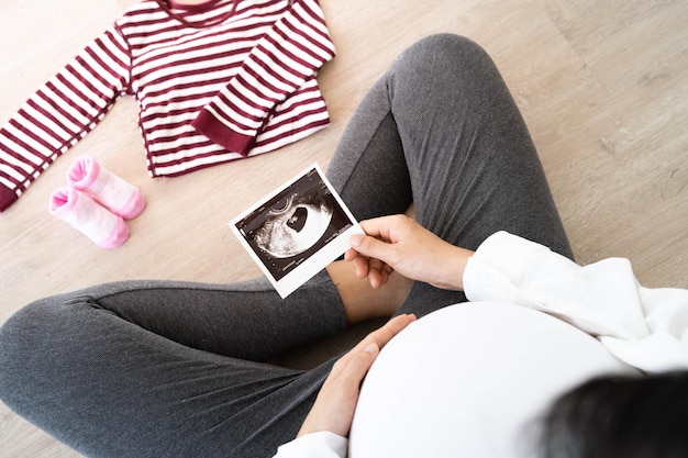 Kobieta W Ciąży Patrzy Na Zdjęcie Płodu Z Usg Matka Delikatnie Dotyka Brzuszka Dzieckakobiety Są W Ciąży Od 23 Dni Lub W Pierwszym Trymestrze Ciąży