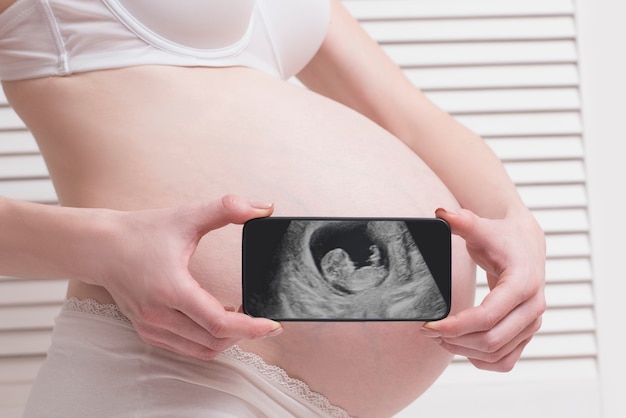 Kobieta w ciąży trzyma smartphone i pokazuje smartphone z płodowym ultradźwiękiem fotografią na białym drewnianym scre w bieliźnie. Zbliżenie