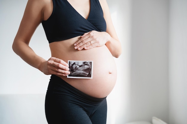 Kobieta w ciąży trzymająca obraz ultradźwiękowy dziecka Zdjęcie brzucha i ultradźwięku w rękach matki Koncepcja ciąży ginekologia badanie medyczne zdrowie matki