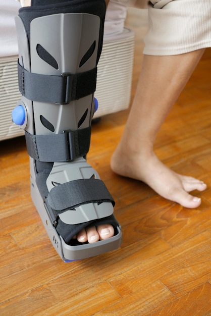 Kobiety złamane stopy z szarym plastikowym butem usztywniającym kostkę butem chroniącym przed urazami