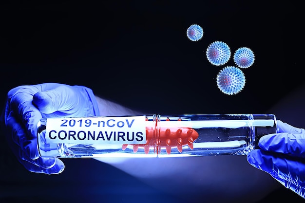 koncepcja koronawirusa 2019-ncov, test zagrożenia biologicznego wirusem in vitro
