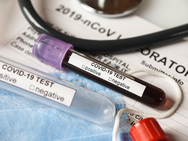 Koncepcja testu koronawirusowego Covid2019 z formularzem testowym probówek do krwi i innymi przedmiotami medycznymi