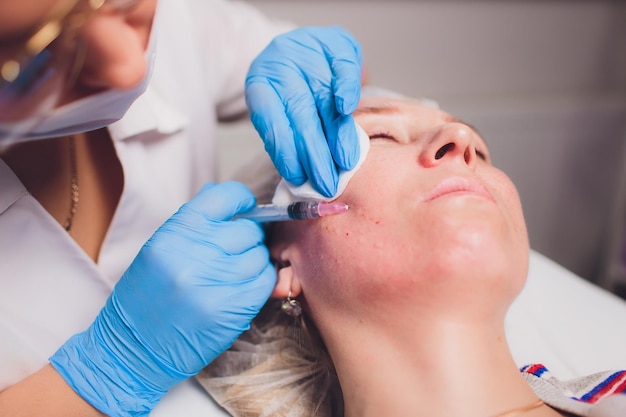 Zdjęcie kosmetyk robi zastrzyk w twarz kobiety z bliska procedura biorevitalizacji