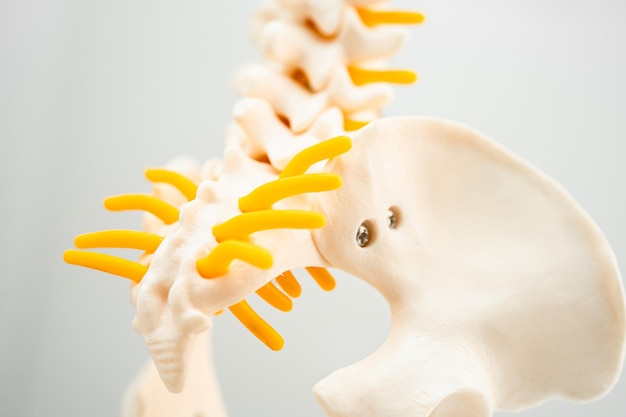 Zdjęcie kręgosłup lędźwiowy z przemieszczeniem przepuklina fragmentu dysku, nerwu rdzeniowego i kości model do leczenia medycznego na oddziale ortopedycznym