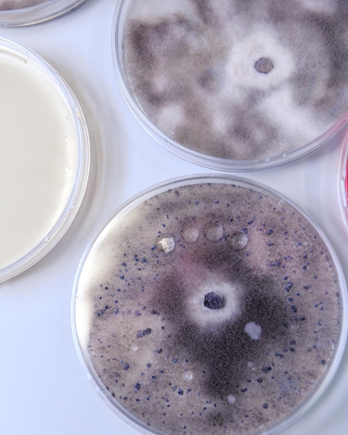 Zdjęcie kultura mikrobiologiczna w naczynia petri do badań w dziedzinie biomedyki farmaceutycznej na temat koronawirusa covid-19