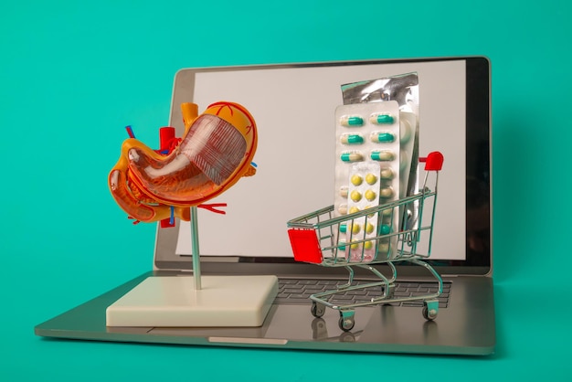 Kup leki z dostawą do domu Mały wózek z lekami i anatomicznym modelem żołądka na laptopie