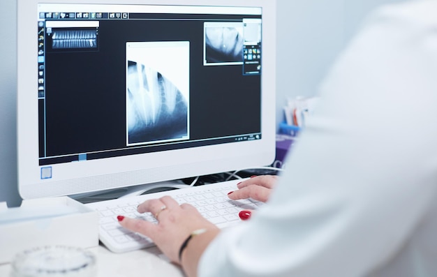 Lekarka patrząca na zdjęcia rentgenowskie i korzystająca z laptopa w szpitalu