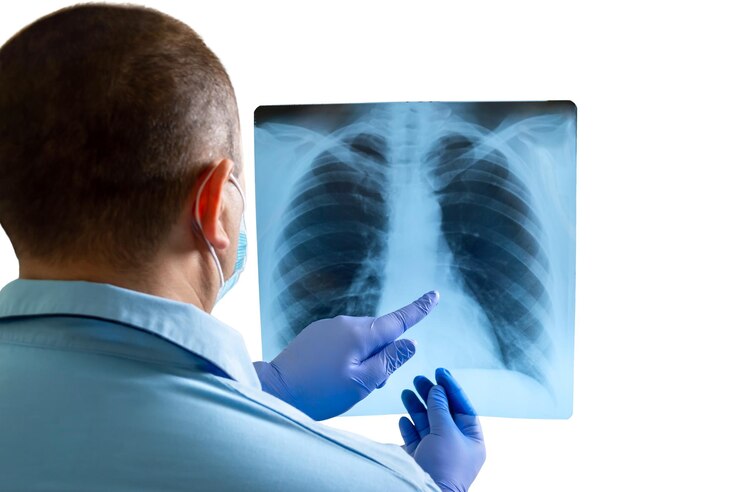 Zdjęcie lekarz bada xray klatki piersiowej i żeber i wskazuje problemy zdrowotne na białym tle makieta na białym tle zbliżenie