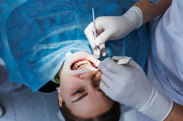 Lekarz Dentysta Bada Zęby Pacjenta Za Pomocą Sprzętu Stomatologicznego. Nowoczesny Sprzęt Medyczny. Znieczulenie Zębów W Znieczuleniu Miejscowym. Pojęcie Leczenia Doustnego. Zbliżenie. Selektywne Skupienie.