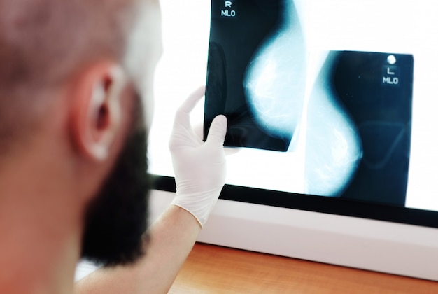 Lekarz ogląda zdjęcie lub mammografię wyniku badania rentgenowskiego gruczołów sutkowych