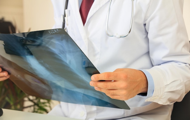 Zdjęcie lekarz patrząc na zdjęcia rentgenowskie