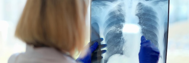 Zdjęcie lekarz patrzy na xray w szpitalu lekarz specjalista w zakresie radiologii i nauk medycznych