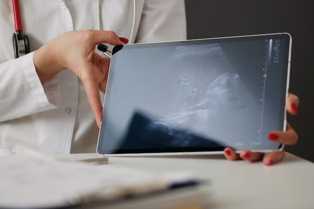 Zdjęcie lekarz pokazujący usg jamy brzusznej na cyfrowym tablecie w zbliżeniu kliniki