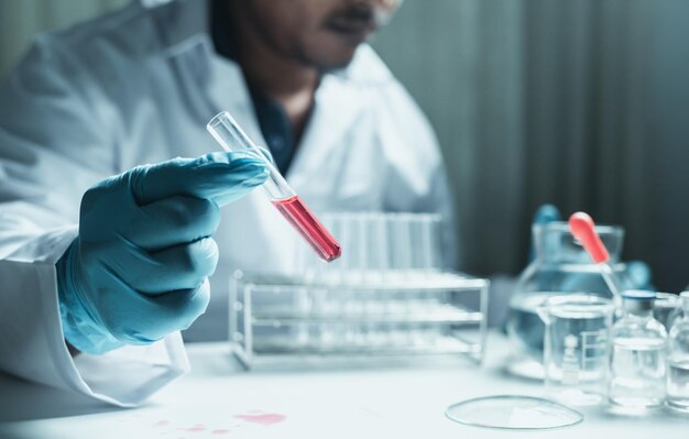 Zdjęcie lekarz trzyma probówkę w uchwycie badanie naczyniowe z eksperymentem badawczym próbki krwi